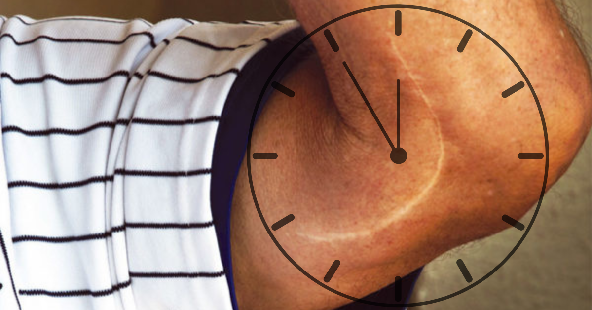 Tommy John Surgery Recovery Time (The Key to Success)