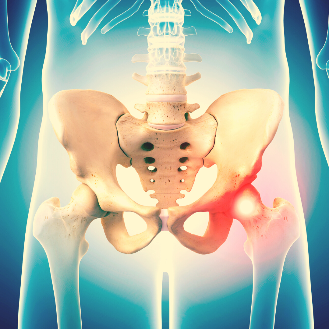 Figuring Out Hip Pain